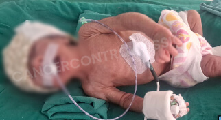 Help baby-of-santosh