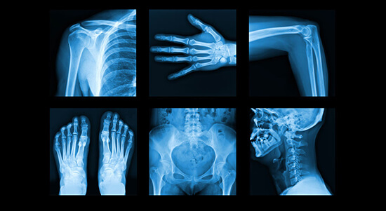 Image of x-rays of different parts of body