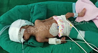 Baby Of Khorate