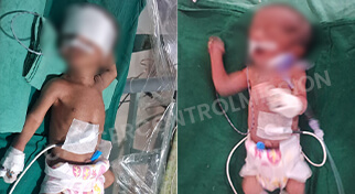 Twin Baby Of Kavita